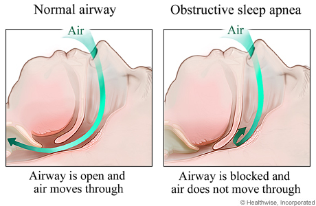 air flow 2